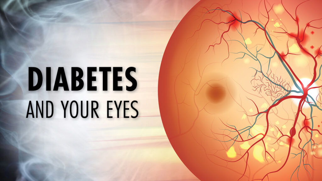 Diabetes-and-Your-Eyes